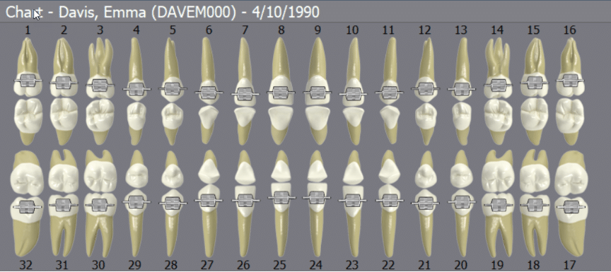 DentiMax Chart Screen