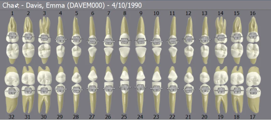 DentiMax Chart Screen